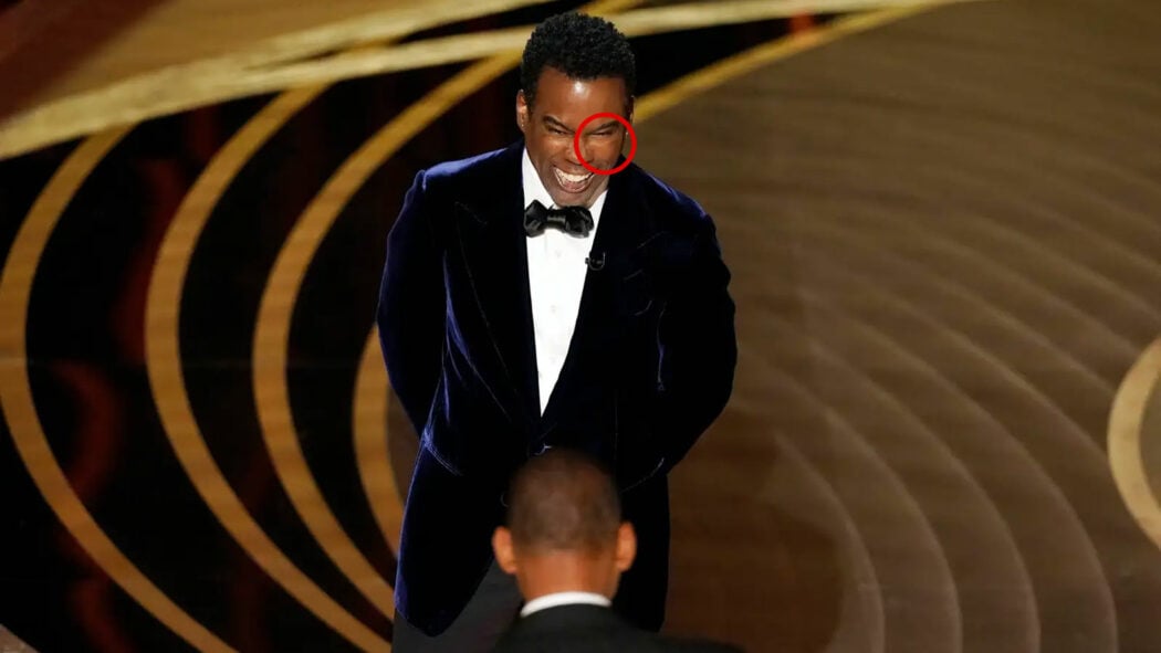 Chris-Rock-Face-Pad-Oscars