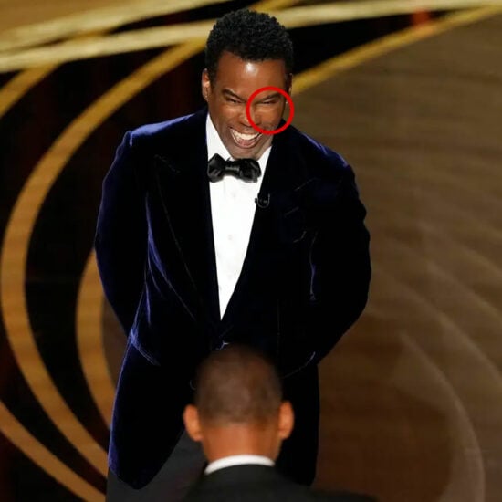 Was Chris Rock Wearing A Face Pad When Will Smith Slapped Him?